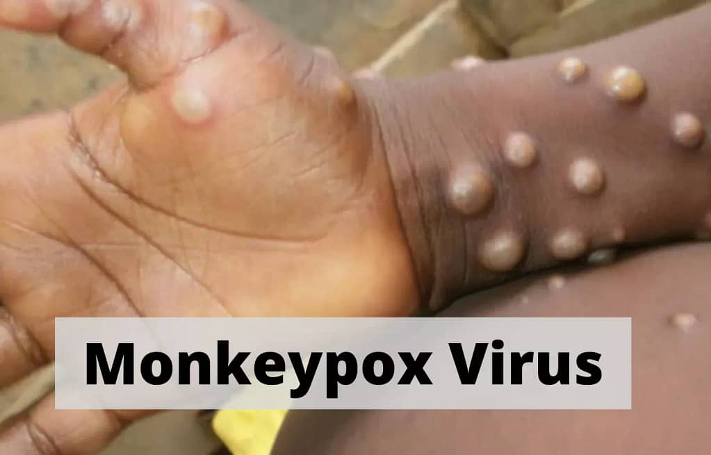 176686 monkeypox virus 2 |