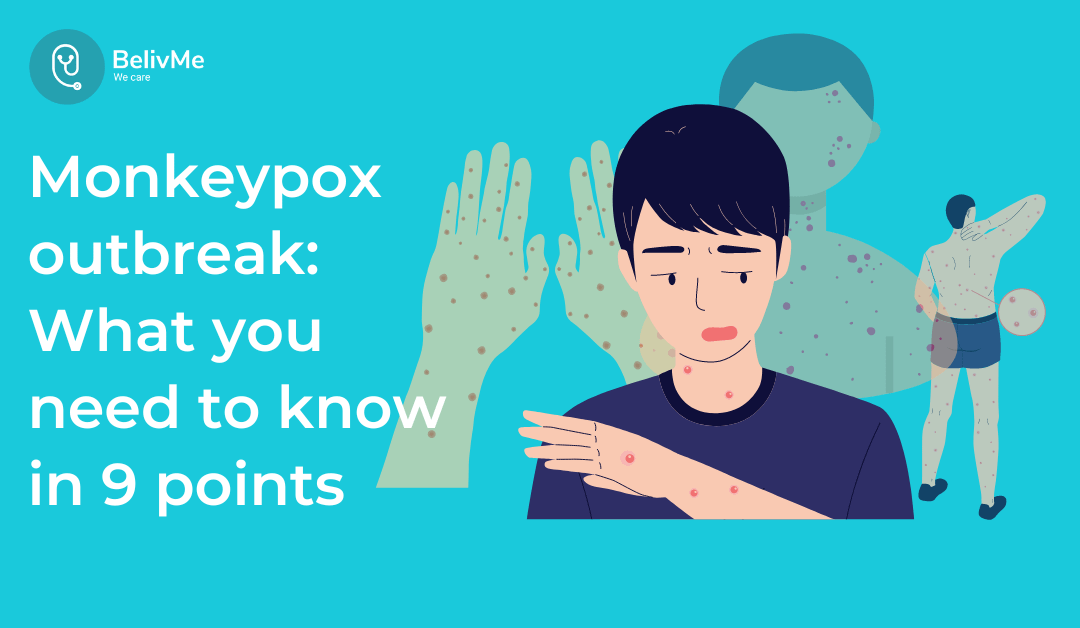 Monkeypox outbreak: What you need to know in 9 points
